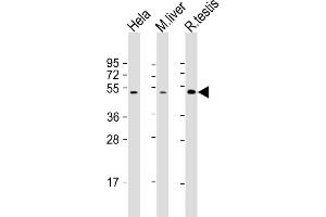 All lanes : Anti-CHRNB2 Antibody (N-Term) at 1:2000 dilution Lane 1: Hela whole cell lysate Lane 2: mouse liver lysate Lane 3: rat testis lysate Lysates/proteins at 20 μg per lane. (CHRNB2 antibody  (AA 66-100))