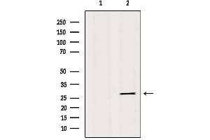 Western blot analysis of extracts from 293, using IBP4 Antibody. (IGFBP4 antibody  (Internal Region))