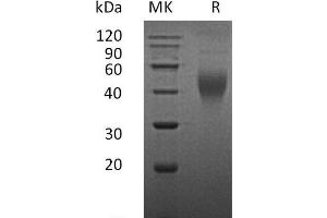 Western Blotting (WB) image for Colony Stimulating Factor 1 (Macrophage) (CSF1) (Active) protein (ABIN7320618) (M-CSF/CSF1 Protein)