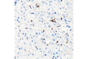 Immunohistochemistry of paraffin-embedded mouse liver using Heme Oxygenase 1 (HO-1/HMOX1) (HO-1/HMOX1) Rabbit mAb  at dilution of 1:100 (40x lens). (HMOX1 antibody)