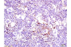 Formalin-fixed and paraffin embedded mouse spleen labeled with Rabbit Anti OPGL/RANKL/ODF Polyclonal Antibody, Unconjugated (ABIN672696) at 1:200 followed by conjugation to the secondary antibody and DAB staining (RANKL antibody  (AA 210-317))