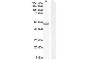 (ABIN570849) (0. (CETP antibody  (N-Term))