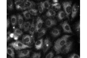 Immunofluorescent staining of A549 (ATCC CCL-185) cells. (Calretinin antibody  (AA 38-151))