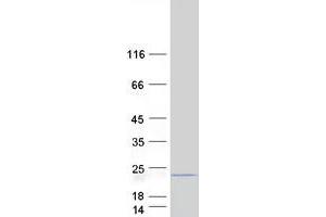 Validation with Western Blot (MRPL17 Protein (Myc-DYKDDDDK Tag))