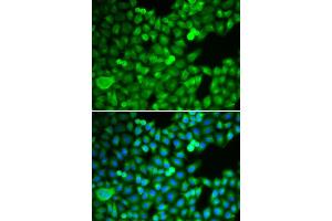 Immunofluorescence analysis of MCF-7 cell using PSMB5 antibody. (PSMB5 antibody  (AA 1-263))