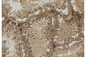 ABIN6276771 at 1/100 staining Mouse testis tissue by IHC-P. (FABP2 antibody  (C-Term))