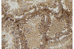 ABIN6276771 at 1/100 staining Mouse testis tissue by IHC-P. (FABP2 antibody  (C-Term))