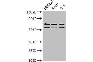 Western Blot Positive WB detected in: HEK293 whole cell lysate, A549 whole cell lysate, U87 whole cell lysate All lanes: CPZ antibody at 3 μg/mL Secondary Goat polyclonal to rabbit IgG at 1/50000 dilution Predicted band size: 74 kDa Observed band size: 74, 59 kDa (CPZ antibody  (AA 21-652))