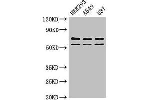 Western Blot Positive WB detected in: HEK293 whole cell lysate, A549 whole cell lysate, U87 whole cell lysate All lanes: CPZ antibody at 3 μg/mL Secondary Goat polyclonal to rabbit IgG at 1/50000 dilution Predicted band size: 74 kDa Observed band size: 74, 59 kDa