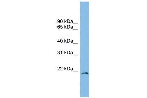 CIRBP antibody used at 1 ug/ml to detect target protein. (CIRBP antibody  (Middle Region))
