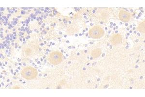 Detection of IRS2 in Human Cerebellum Tissue using Polyclonal Antibody to Insulin Receptor Substrate 2 (IRS2) (IRS2 antibody)