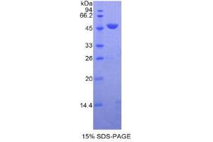 SDS-PAGE (SDS) image for Folate Receptor 1 (Adult) (FOLR1) (AA 25-234) protein (His tag) (ABIN2121089)