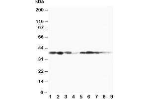 Western blot testing of MEK3 antibody and Lane 1:  rat spleen;  2: rat thymus;  3: rat skeletal muscle;  4: rat kidney, and human samples  5: MCF-7;  6: HeLa;  7: Raji;  8: CEM;  9: COLO320 cell lysate (MAP2K3 antibody  (C-Term))