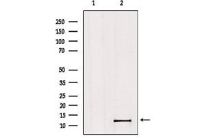 Western blot analysis of extracts from Hela, using MED11 Antibody. (MED11 antibody  (Internal Region))