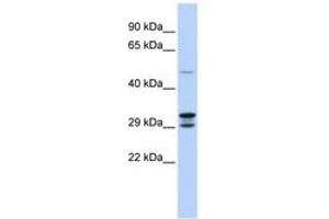 Image no. 1 for anti-Chromosome 14 Open Reading Frame 166 (C14orf166) (N-Term) antibody (ABIN6742833) (C14orf166 antibody  (N-Term))