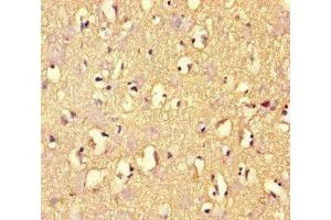 Immunohistochemistry of paraffin-embedded human brain tissue using ABIN7167960 at dilution of 1:100 (ARHGAP42 antibody  (AA 541-728))