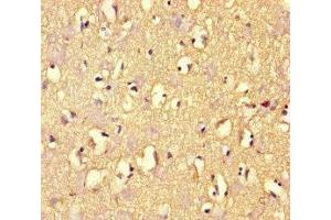 Immunohistochemistry of paraffin-embedded human brain tissue using ABIN7167960 at dilution of 1:100 (ARHGAP42 antibody  (AA 541-728))