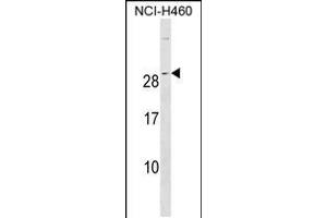 Western blot analysis in NCI-H460 cell line lysates (35ug/lane). (rala antibody  (C-Term))