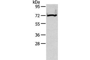 Western Blot analysis of Mouse kidney tissue using CPT2 Polyclonal Antibody at dilution of 1:200 (CPT2 antibody)