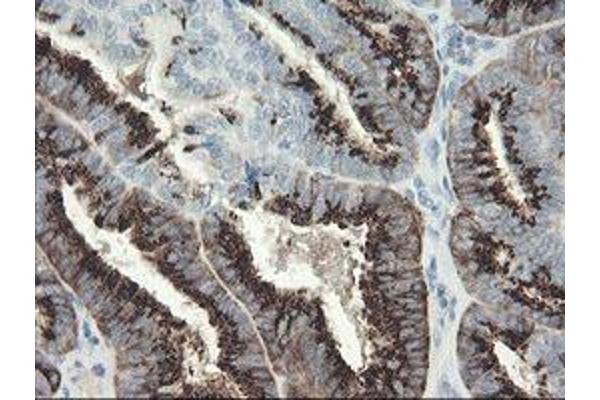 SLAP2 antibody