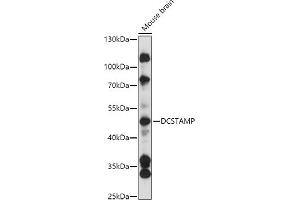 Western blot analysis of extracts of Mouse brain, using DCSTAMP antibody (ABIN7270939) at 1:3000 dilution. (Transmembrane 7 Superfamily Member 4 (TM7SF4) (AA 401-470) antibody)
