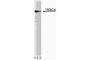 Western blot analysis of Clathrin Heavy Chain on HeLa cell lysate (center). (Clathrin antibody  (AA 4-171))