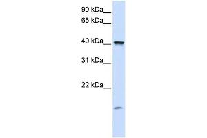 TMEM79 antibody used at 1 ug/ml to detect target protein. (TMEM79 antibody  (C-Term))