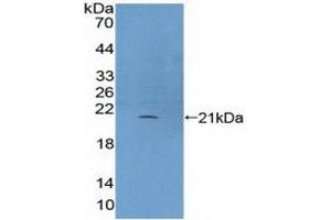 Detection of Recombinant PLCb3, Human using Polyclonal Antibody to Phospholipase C Beta 3, Phosphoinositide Specific (PLCb3) (Phospholipase C beta 3, Phosphoinositide Specific (AA 318-468) antibody)