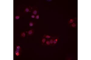 ABIN6277454 staining Hela cells by IF/ICC. (PPP2CB antibody  (C-Term))