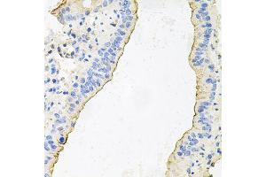Immunohistochemistry of paraffin-embedded mouse lung using HPR antibody (ABIN6003630) at dilution of 1/100 (40x lens). (HPR antibody)