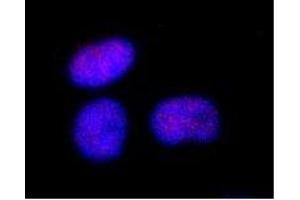 Immunofluorescence (IF) image for anti-SWI/SNF Related, Matrix Associated, Actin Dependent Regulator of Chromatin, Subfamily A, Member 4 (SMARCA4) (C-Term) antibody (ABIN2451926) (SMARCA4 antibody  (C-Term))