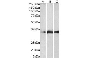 ABIN2563589 (2µg/ml) staining of Human Brain (Cerebellum) (A), Mouse Brain (B) and Rat Brain (C) lysates (35µg protein in RIPA buffer). (Kallikrein 5 antibody  (Internal Region))