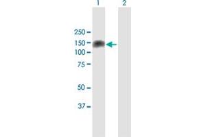 Western Blotting (WB) image for anti-Protein Kinase N1 (PKN1) (AA 1-942) antibody (ABIN950034)