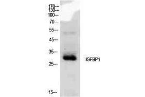 Western Blotting (WB) image for anti-Insulin-Like Growth Factor Binding Protein 1 (IGFBPI) (Internal Region) antibody (ABIN3178913) (IGFBPI antibody  (Internal Region))