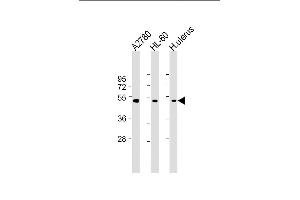 All lanes : Anti-B Antibody (Center) at 1:2000 dilution Lane 1:  whole cell lysate Lane 2: HL-60 whole cell lysate Lane 3: Human uterus lysate Lysates/proteins at 20 μg per lane. (BMP15 antibody  (AA 241-271))