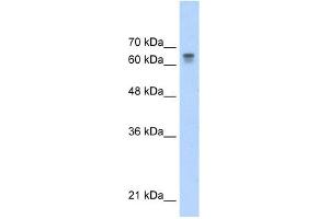 PARP6 antibody used at 0. (PARP6 antibody)