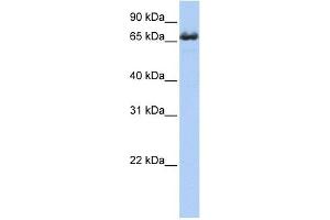 ZDHHC17 antibody used at 1 ug/ml to detect target protein. (ZDHHC17 antibody  (Middle Region))