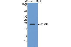 Detection of Recombinant CTSL, Rat using Polyclonal Antibody to Cathepsin L (CTSL) (Cathepsin L antibody  (AA 114-288))