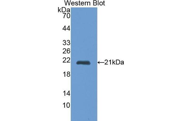 Cathepsin L antibody  (AA 114-288)