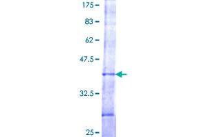 Image no. 1 for Vacuolar Protein Sorting 52 Homolog (VPS52) (AA 625-723) protein (GST tag) (ABIN1325097) (VPS52 Protein (AA 625-723) (GST tag))