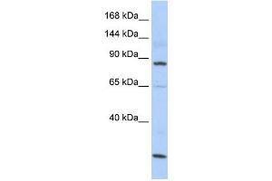 MSH5 antibody used at 1 ug/ml to detect target protein. (MSH5 antibody)