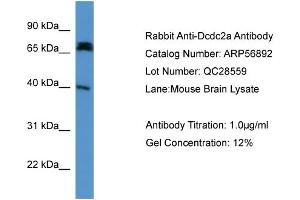 WB Suggested Anti-Dcdc2a  Antibody Titration: 0. (DCDC2 antibody  (N-Term))