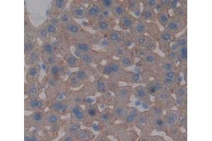Used in DAB staining on fromalin fixed paraffin- embedded liver tissue (ABCG5 antibody  (AA 66-276))