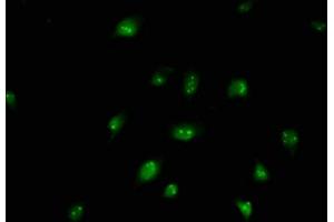 Immunofluorescence staining of U251 cells with ABIN7145872 at 1:250, counter-stained with DAPI. (BUD13 antibody  (AA 132-233))