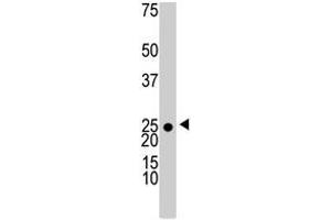 The KHK polyclonal antibody  is used in Western blot to detect KHK in 293 cell lysate . (Ketohexokinase antibody  (N-Term))