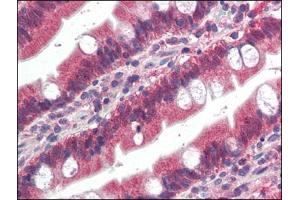 Human Small Intestine (formalin-fixed, paraffin-embedded) stained with FGFR1at 4 µg/ml followed by biotinylated anti-goat IgG secondary antibody, alkaline phosphatase-streptavidin and chromogen. (FGFR1 antibody  (C-Term))