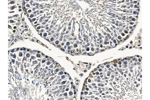 FOXO4 Mouse Monoclonal Antibody at 1/100 staining rat testis tissue by IHC-P.