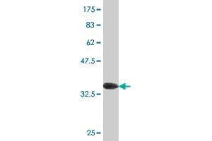 Western Blot detection against Immunogen (36. (MSRB2 antibody  (AA 102-201))