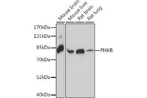 Western blot analysis of extracts of various cell lines, using PI4KB antibody (ABIN7269287) at 1:1000 dilution. (PI4KB antibody  (AA 560-801))