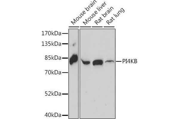 PI4KB anticorps  (AA 560-801)